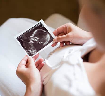 A woman holding an ultrasound picture in her hands.